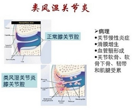 成都京研风湿病研究院